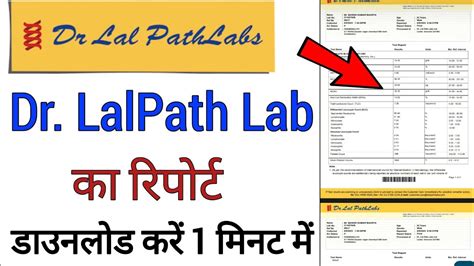 dr lal pathlabs report download online|dr lal pathlabs invoice download.